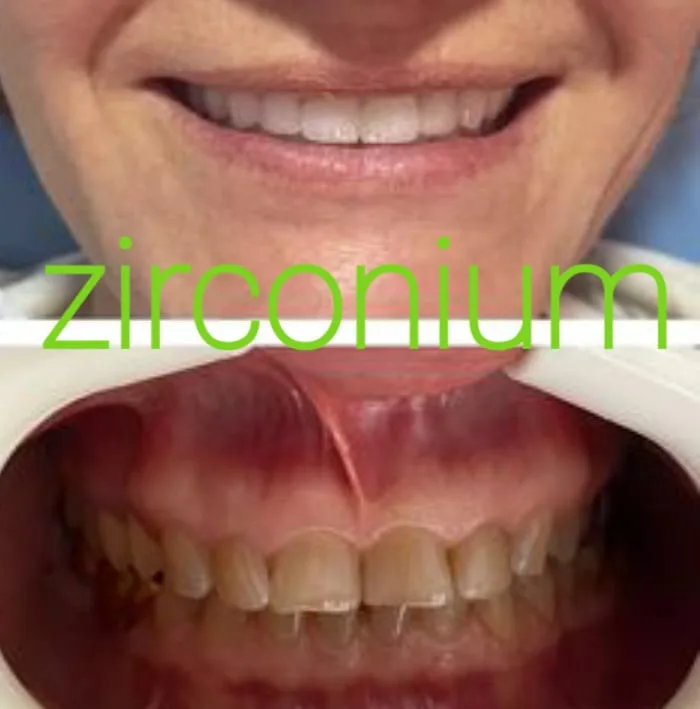 Alanya HEALTHY TEETH Dental Aesthetic — Medicina em Alanya: Encomenda online, preços e comentários